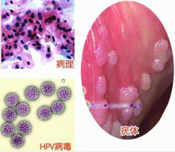 ����ʪ��ͼƬ