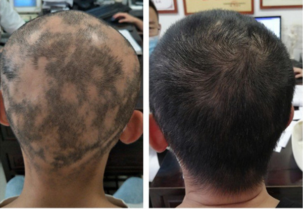 �������������ư�ͺ