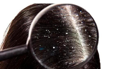 Ϊʲôͷм�ࡢͷƤ����Խϴ����Խ����