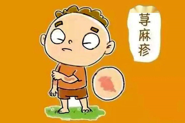 荨麻疹会传染给别人吗