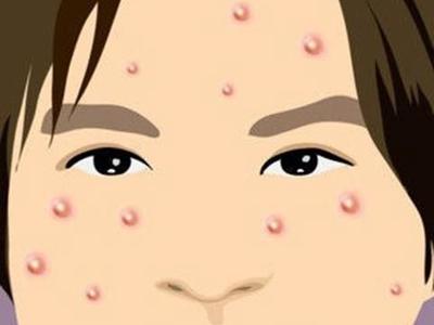 ��������ҽԺ�ഺ���εĺ���