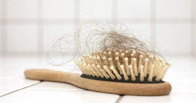 如何区分脱发和掉头发