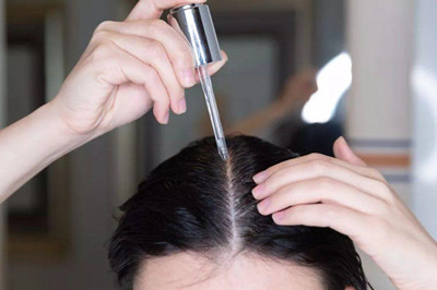 如何区分脱发和掉头发