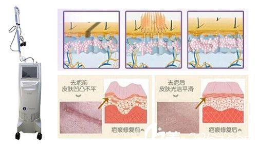 �������һ�ξ��ܺ���