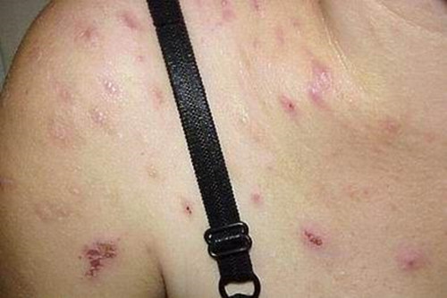 ��������������Ƥ����