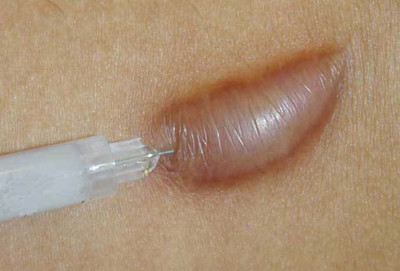 �̺۸���һֱ�ڳ�Ӧ����ô��