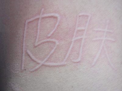 ��ͬ����ݡ�����֢״����Щ