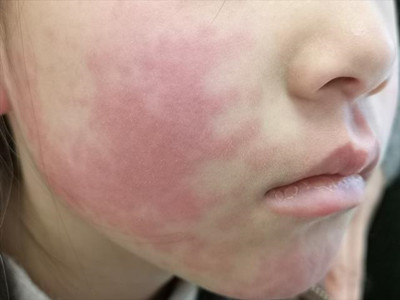 ������Ƥ�����������Լ����δ�ʩ