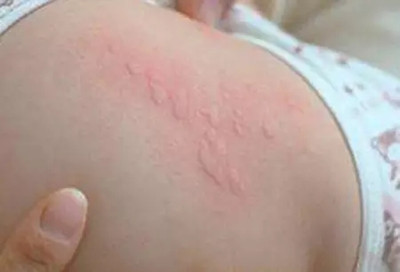 ������Ƥ�����������Լ����δ�ʩ