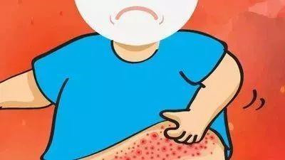 得过带状疱疹的人还会再得吗