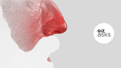 毒蝎王药膏可治疗玫瑰痤疮吗