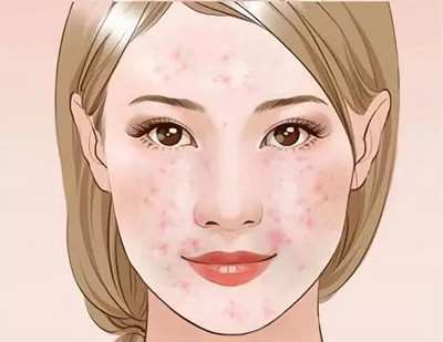 õ������ƶ�ú����������ױ