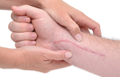 疤痕疙瘩越来越痛怎么办好