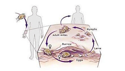 �괯��ʲôҩ���ƺõÿ�