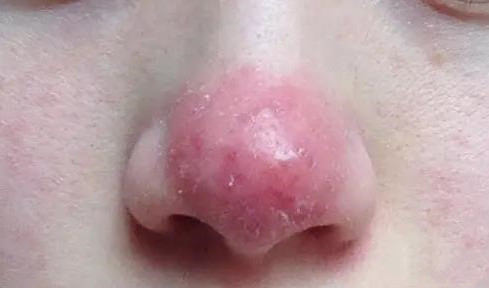 õ������ߣ�ƽʱҪ��λ���Ƥ����