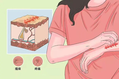 疤痕疙瘩不治疗,会一直长下去吗?