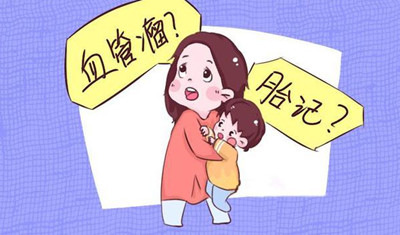 胎记怎么来的?除了遗传,孕期尽量避开这3种行为!