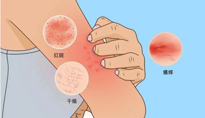 ��������Ƥ�������� ԭ������4��ԭ����ɵģ�